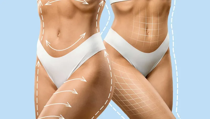 Why Turkey’s Clinics Are Renowned for Body Surgeries
